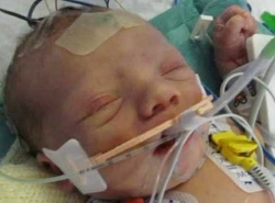 Riley Joyce, the first baby to receive the treatment