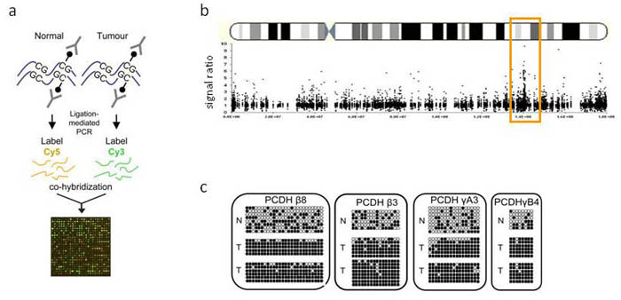 Long range epigenetic silencing in Wilms' tumour