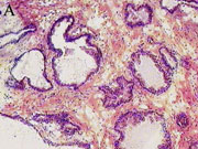 Normal prostate cells.