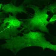 Brain stem astrocytes taken using a confocal microscope
