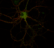 An image of a hippocampal neuron stained for endogenous RIM1 and SUMO. RIM1 is in red and SUMO in green.