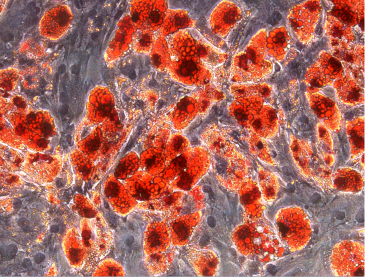 Human fat stem cells differentiated into adipocytes and stained with Oil O Red