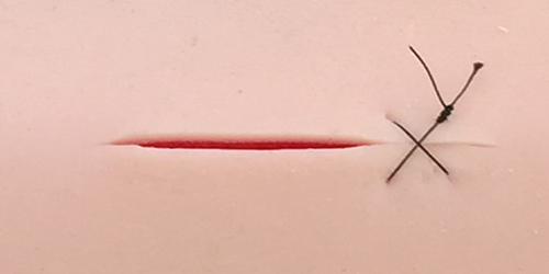 suturing example in silicone pad