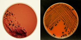 microbiology-plates